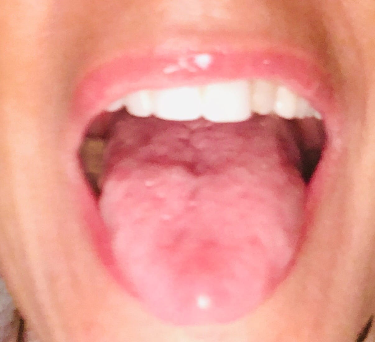 Cassandra75